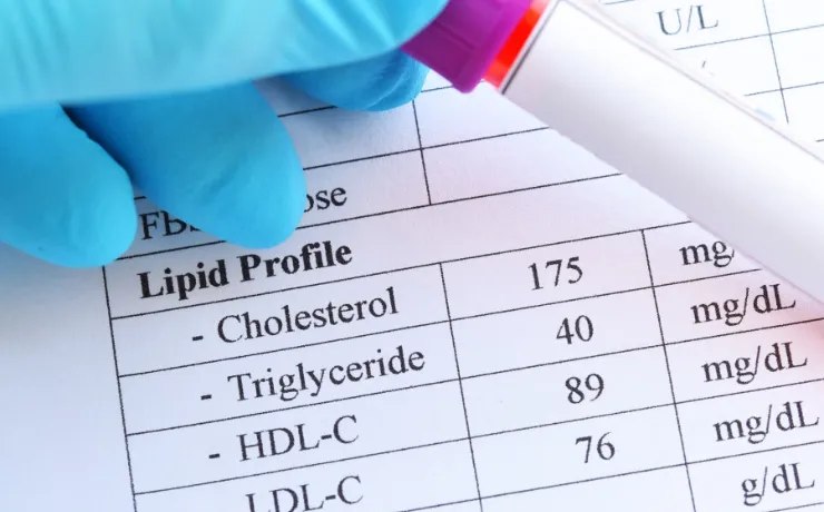 Should You Be Getting Regular Cholesterol Screenings?